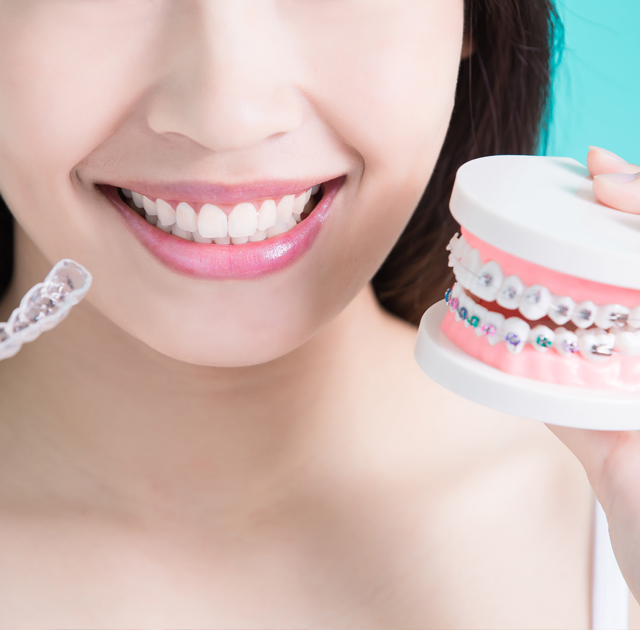 Ceramic Braces